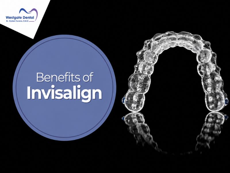 Invisalign - Image 1