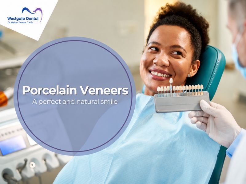 Veneers - Image 1
